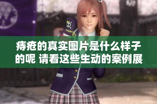 痔疮的真实图片是什么样子的呢 请看这些生动的案例展示