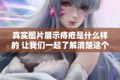 真实图片展示痔疮是什么样的 让我们一起了解清楚这个常见问题